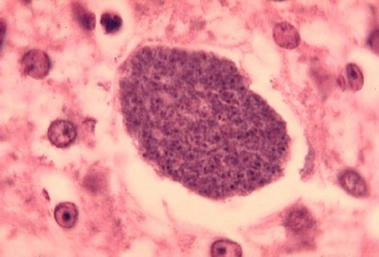 Liver Hepatocyte