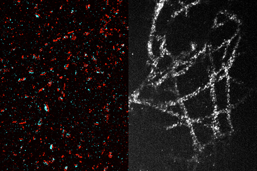 In the image at left, presynaptic proteins are labeled in red, and postsynaptic proteins are labeled in blue. Each blue-red “sandwich” represents a synapse.