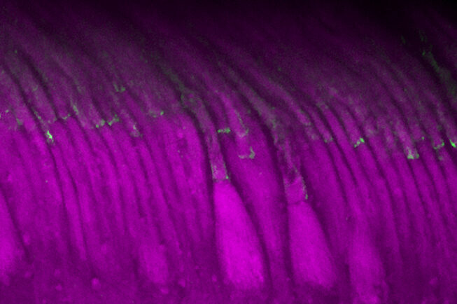 An experimental gene therapy raised levels of the key protein protocadherin-15, shown in green, in light-sensing cells in the retinas of nonhuman primates.