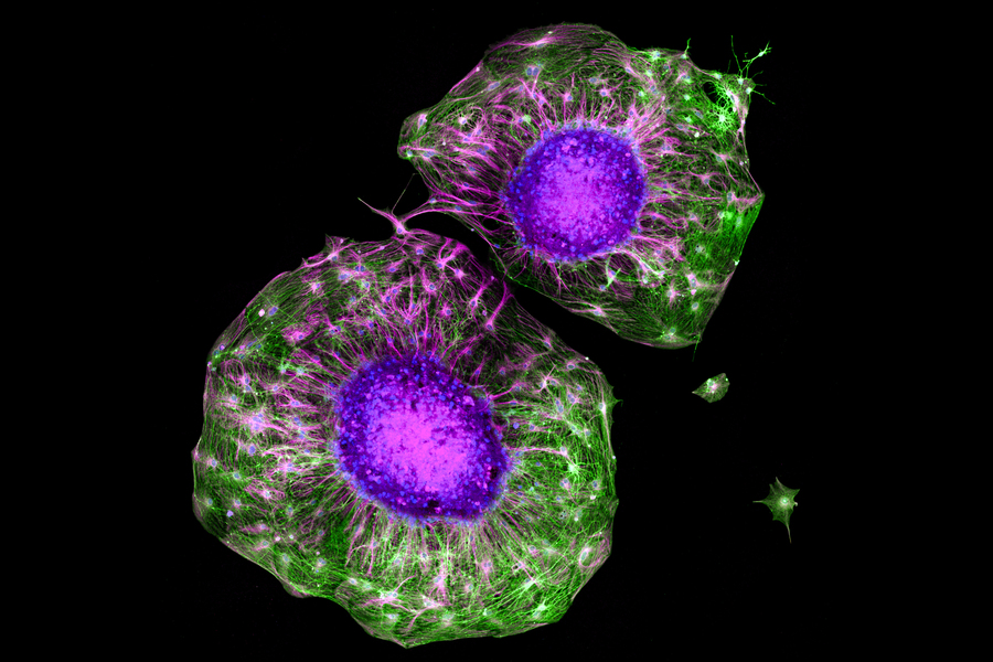 In response to biochemical and physical cues of exercise, motor neurons (in purple) exhibit new growth (in green) faster than neurons that experience no exercise-induced cues.