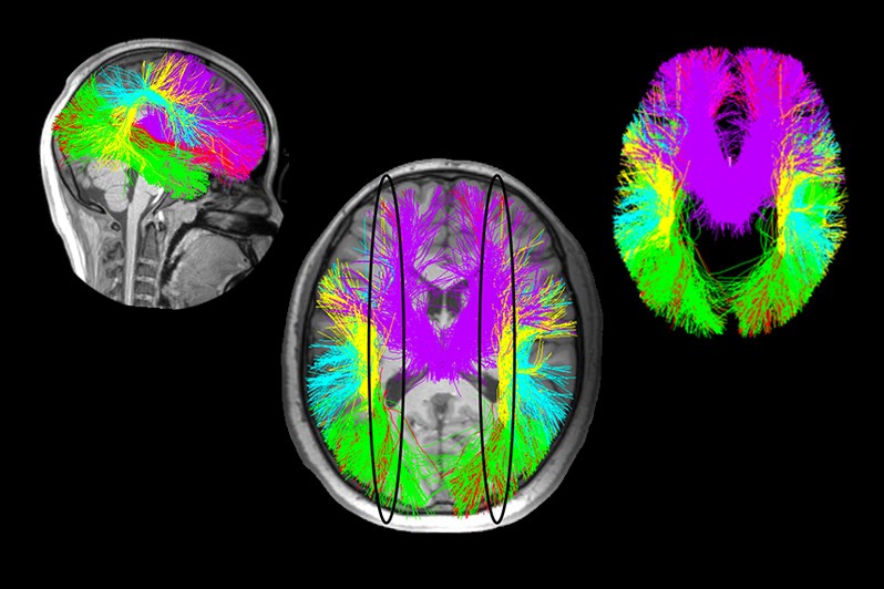 dMRI image