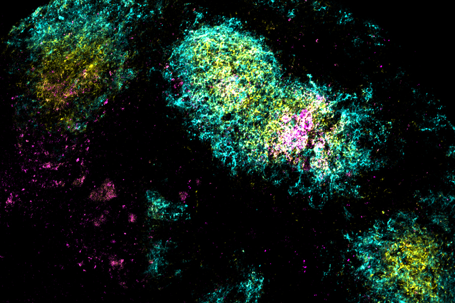 Image shows the vaccine antigen (pink) being concentrated in a germinal center (yellow) within B cell follicles (cyan), triggered by the researchers’ combination adjuvant vaccine.