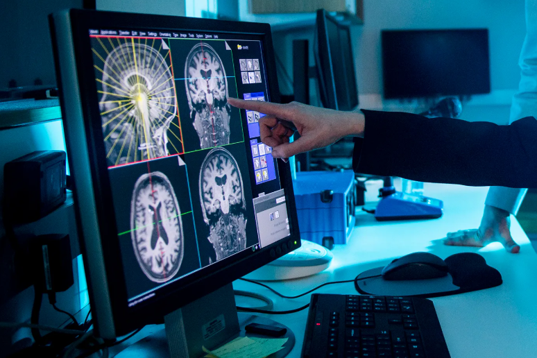 computer with MRI images of a brain