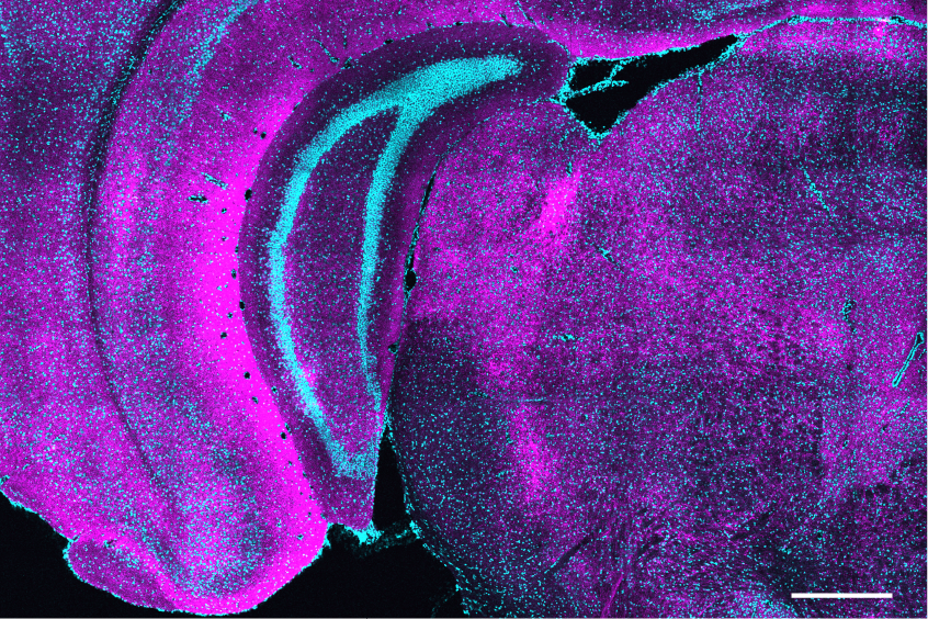 A cross section of a mouse brain shows SST neuron boutons in magenta with cell nuclei staining (via DAPI) in cyan.