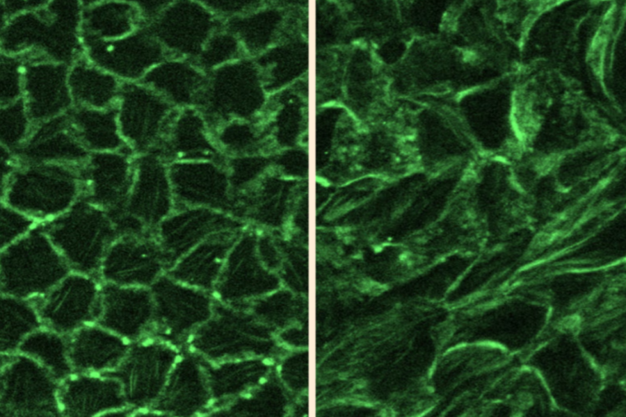 epithelial cells with stress fiber formation in mechanically squeezed cells (right) compared to control (left)