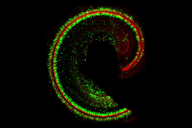 The inner ear hearing organ of a mouse
