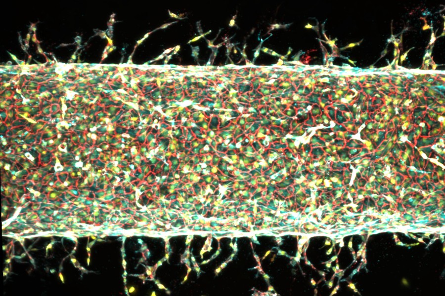artificial arteries