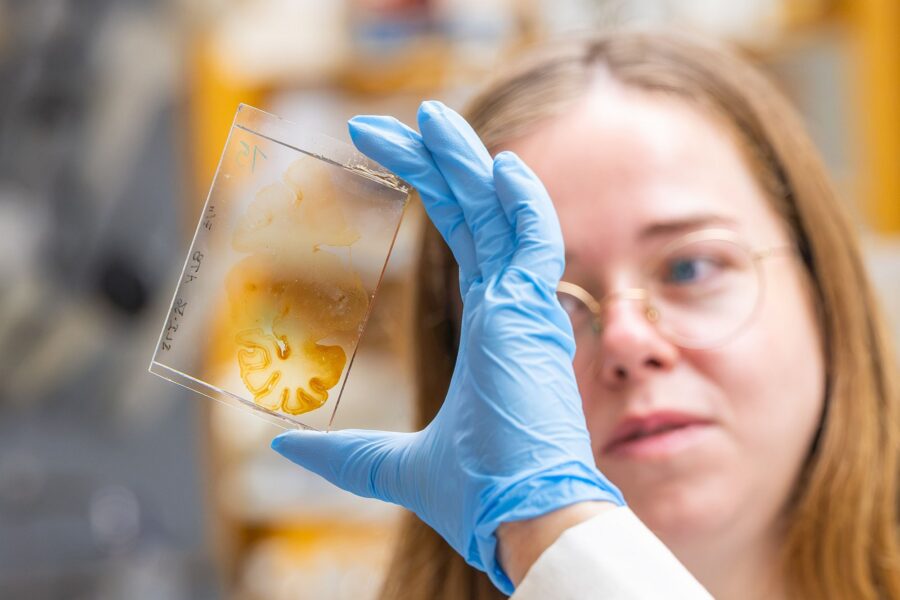 PhD candidate Kerry Breen holding a brain sample